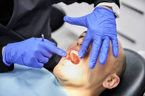 Best Emergency Dentist for Knocked-Out Tooth in Coronita, CA