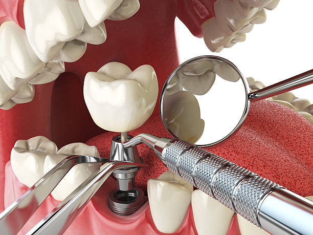 Best Emergency Dentist for Special Needs Patients in Coronita, CA
